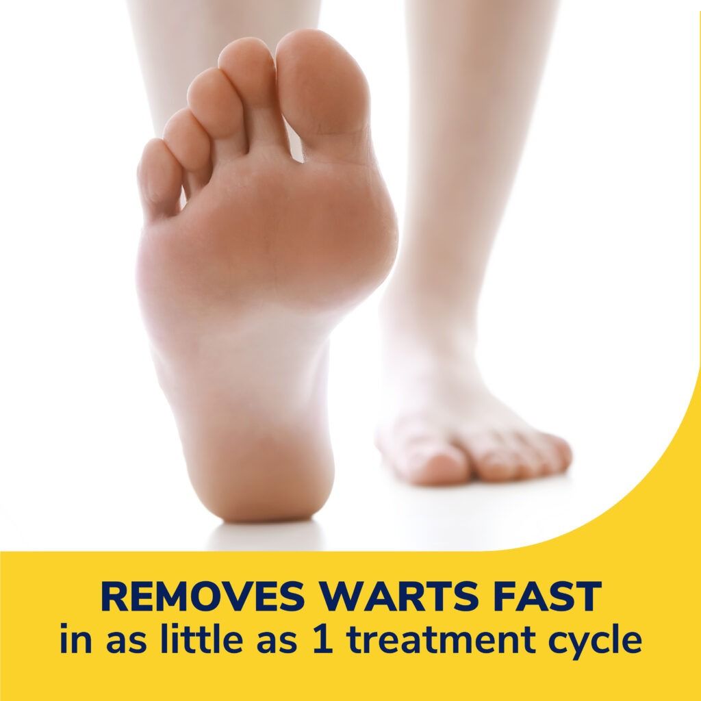 Freeze Away® Wart Remover For At Home Wart Removal | Dr. Scholl's