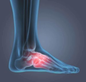 Sore & Extreme Heel Pain & Relief | Dr. Scholl's